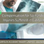 Compensation for Spinal Work Injuries Suffered in Ontario, California